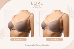 Breast reconstruction symmetry results before and after in Dubai — Elive Aesthetic Clinic Al Quoz