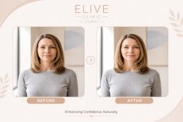 Breast reconstruction side profile before and after results at Elive Clinic Dubai Al Quoz