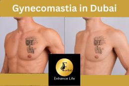 before and after breast reduction treatment in Dubai