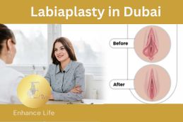 Labiaplasty surgery results in Dubai before and after comparison at Elive Aesthetic Clinic