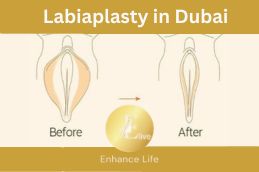 Before and after labiaplasty procedure performed by board-certified surgeon in Dubai