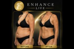 Before and after breast lift results in Dubai — natural youthful shape achieved through mastopexy surgery at Elive Clinic Dubai