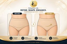 Intimate surgery in Dubai before and after – natural results by female doctor at Elive Clinic