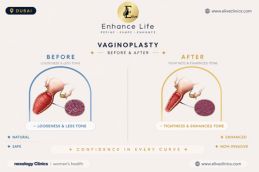 After vaginoplasty results in Dubai showing tightened vaginal canal at Elive Clinic Al Quoz