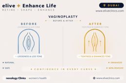 Before and after vaginoplasty in Dubai at Elive Clinic showing vaginal rejuvenation results