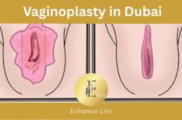 Before vaginoplasty surgery in Dubai showing vaginal laxity condition at Elive Clinic