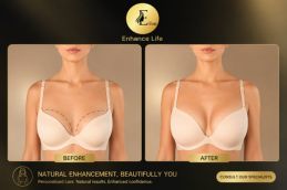 breast augmentation before and after results at Elive Clinic Dubai