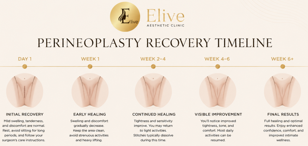 Perineoplasty surgery recovery timeline showing healing stages from day one to three months - Elive Clinic Dubai