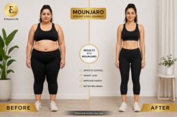 Before and after weight loss results with Mounjaro injections at Elive Clinic Dubai