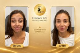 Before and After Dubai & Abu Dhabi