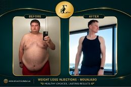 Before and After Mounjaro injections