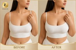 before and after result of breast reduction in Dubai & Abu Dhabi
