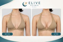 Before and after images of breast treatment
