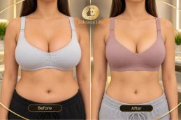 before and after results of Breast Lump Treatment in Dubai & Abu Dhabi